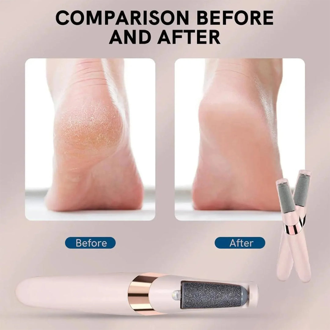 HEYMKGO Pedicure Electronic Tool File Feet Callus Remover Hard Skin Remover Foot Care Tools