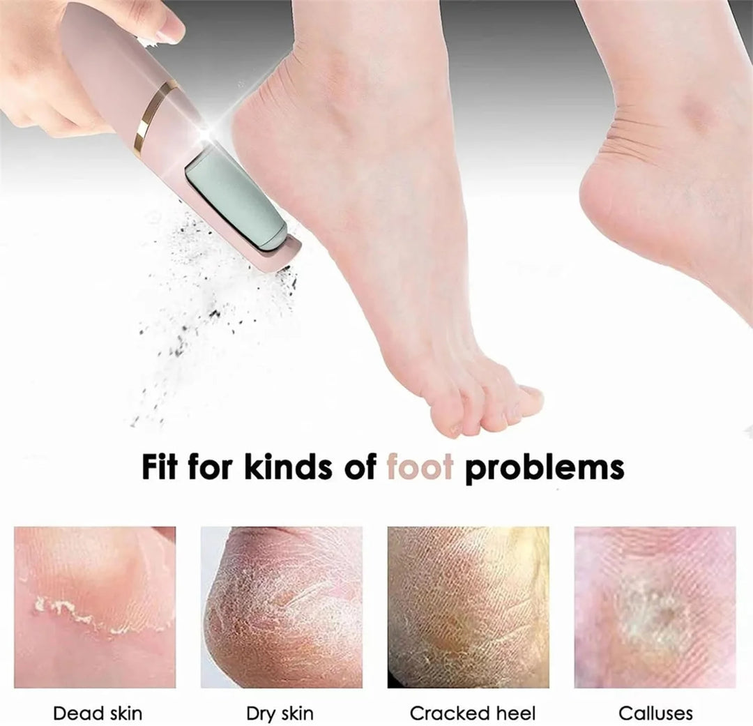 HEYMKGO Pedicure Electronic Tool File Feet Callus Remover Hard Skin Remover Foot Care Tools